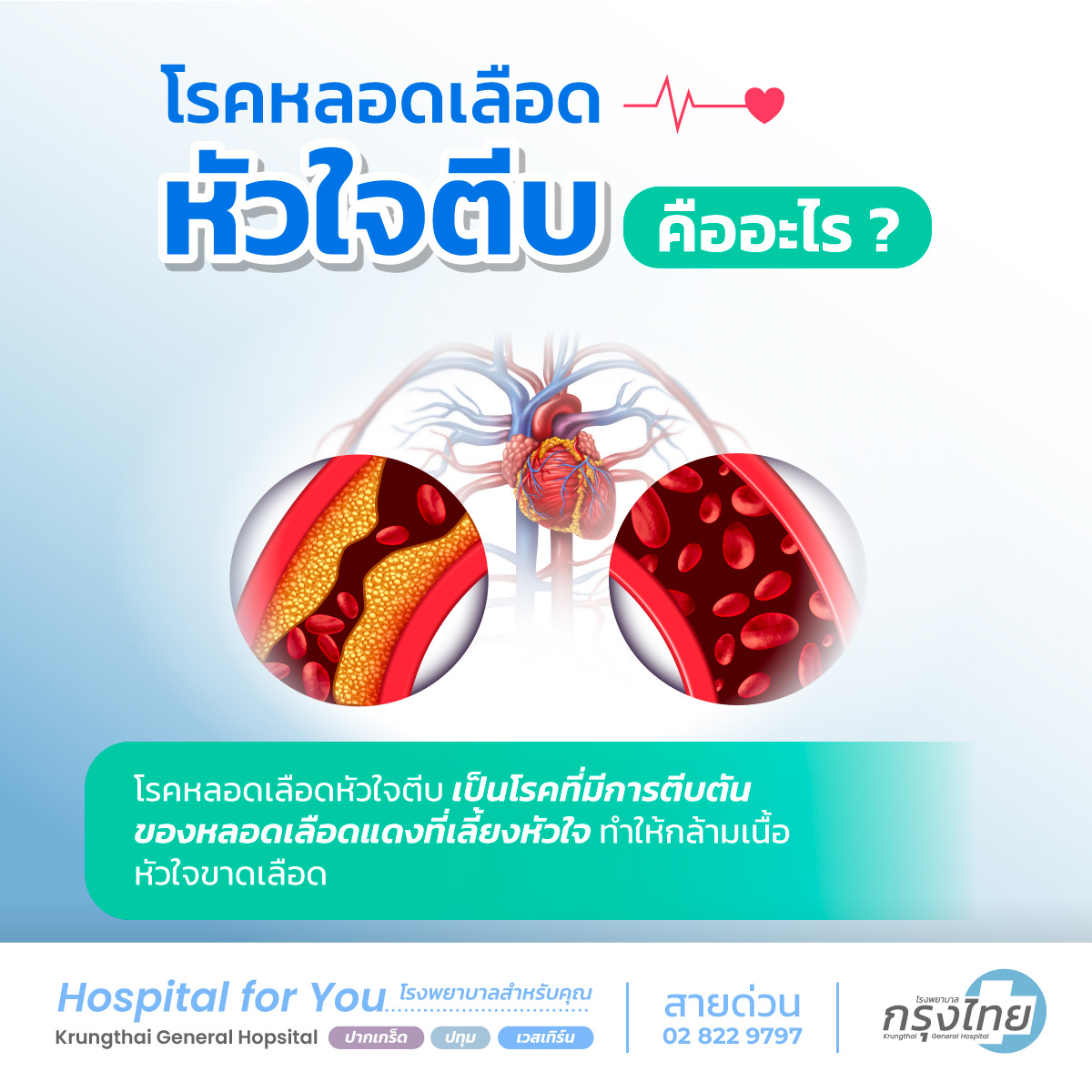 โรคหลอดเลือดหัวใจตีบคืออะไร